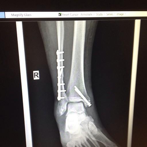 11745643_1699955956894951_5874680624591395804_n